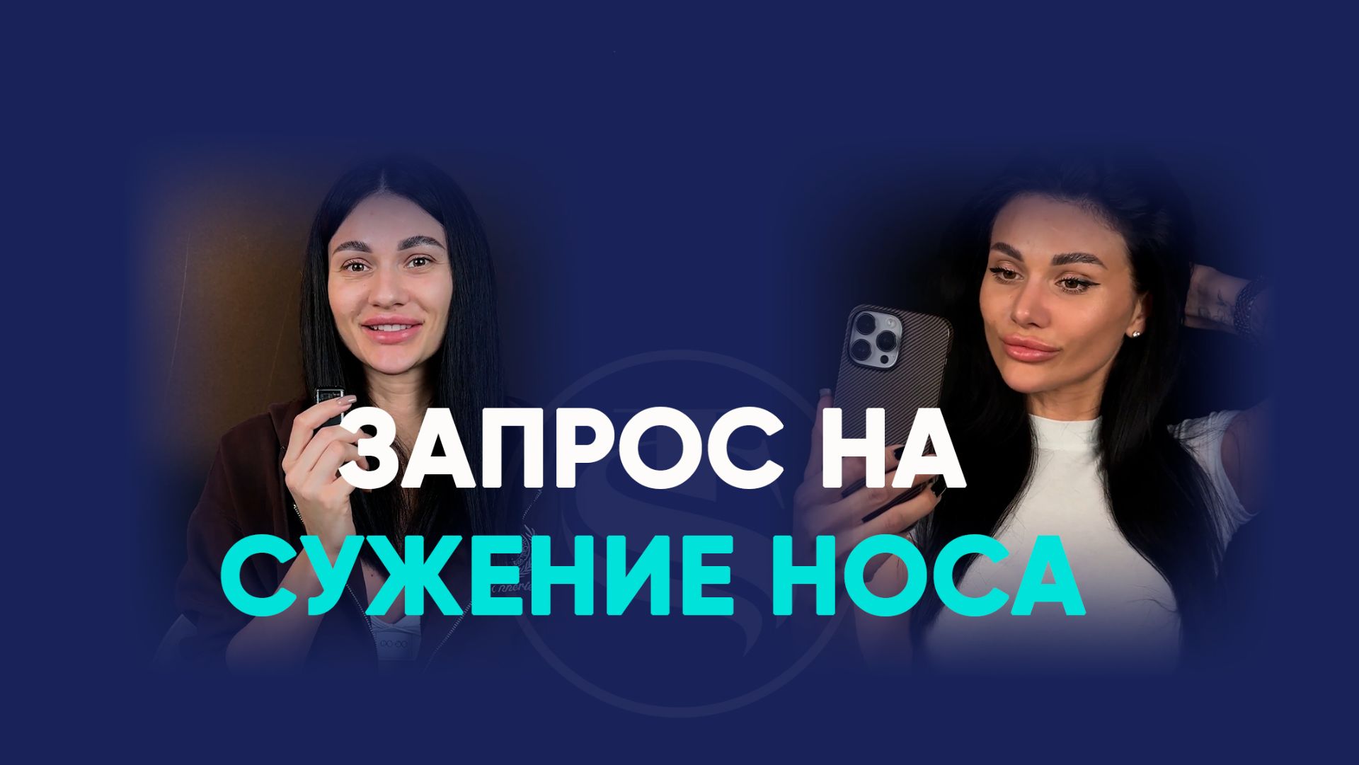Открытая риносептопластика: как меняется нос через 2 недели, 1 месяц, 2 месяца и 6 месяцев