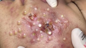 Достигните внутреннего покоя с помощью этих методов очищения лица