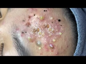 Обретите внутренний покой с помощью этих методов очищения лица
