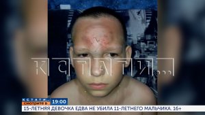 Смотрите сегодня в 19.00 в программе «Кстати»: 15-летняя девочка едва не убила 11-летнего мальчика