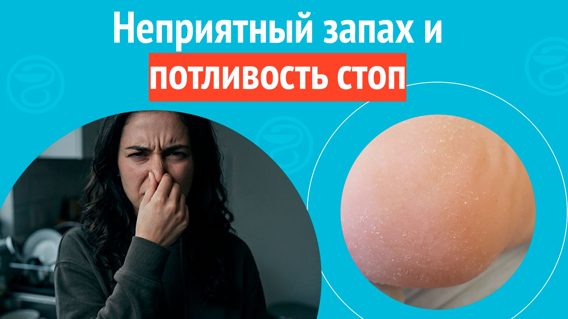 🦶 Неприятный запах и потливость стоп. Клинический случай № 1826
