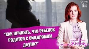 «Как принять, что ребенок родится с синдромом Дауна?». Прямая линия жизни