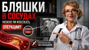 ВЫСОКИЙ ХОЛЕСТЕРИН: НУЖНЫ ЛИ СТАТИНЫ НА САМОМ ДЕЛЕ? ЛЕЧЕНИЕ АТЕРОСКЛЕРОЗА И ЖИЗНЬ ПОСЛЕ СТЕНТА!