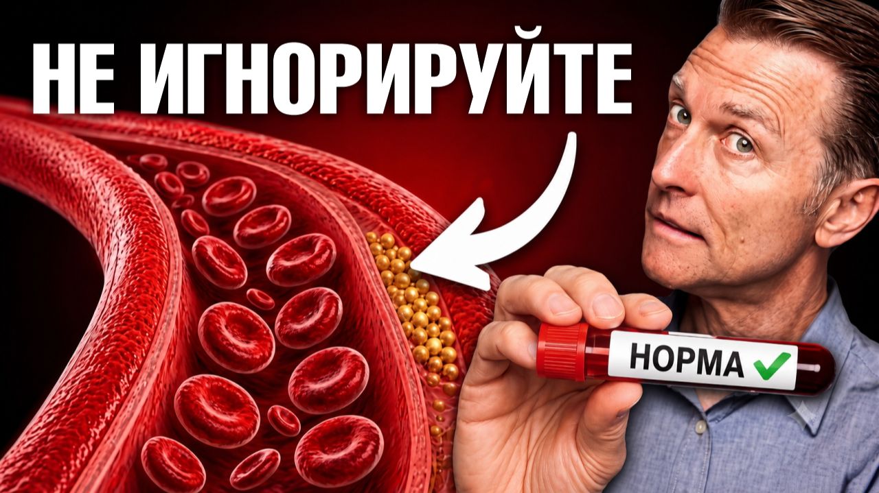 Перестаньте бояться высокого холестерина, пока не узнаете ЭТО
