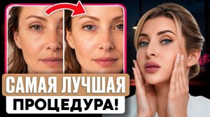 Все что НУЖНО ЗНАТЬ про биоревитализацию! Как сохранить молодость?