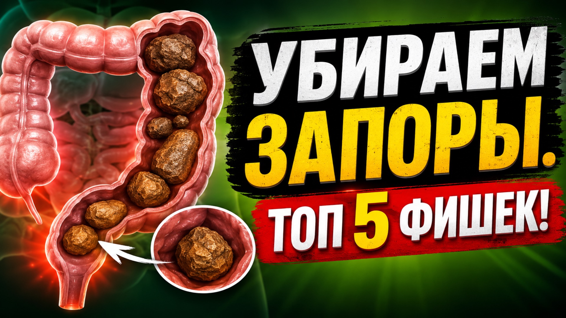 ТОП5 эффективных методов от запоров
