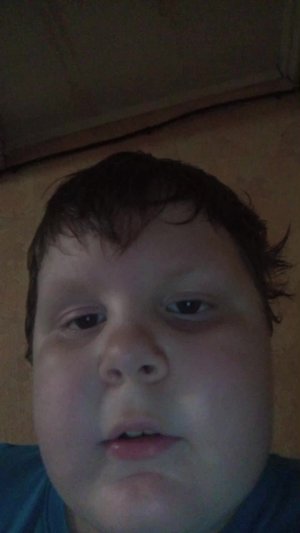 766776