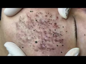 Обретите внутренний покой с помощью этих методов очищения лица
