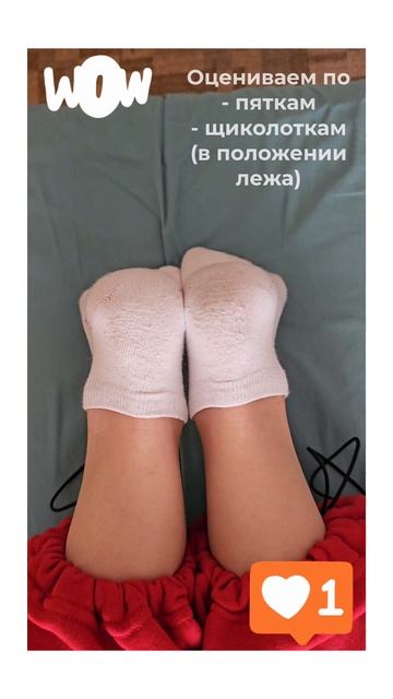 Смещение КПС + Сколиоз