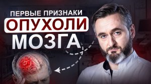 Опухоль мозга: симптомы, которые нельзя игнорировать