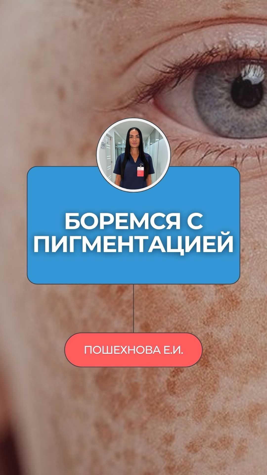 Что купить в аптеке от пигментных пятен? Я косметолог. Готовая схема 👇 Сохраняй 🔖