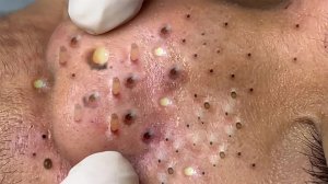 Обретите внутренний покой с помощью этих методов очищения лица.