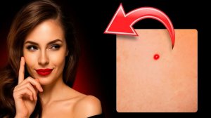 Красные точки на коже 🔴 Этот симптом указывает на болезнь, о которой вы не знаете ⚠️