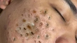 Achieve Inner Peace with These Facial Cleansing Meth�