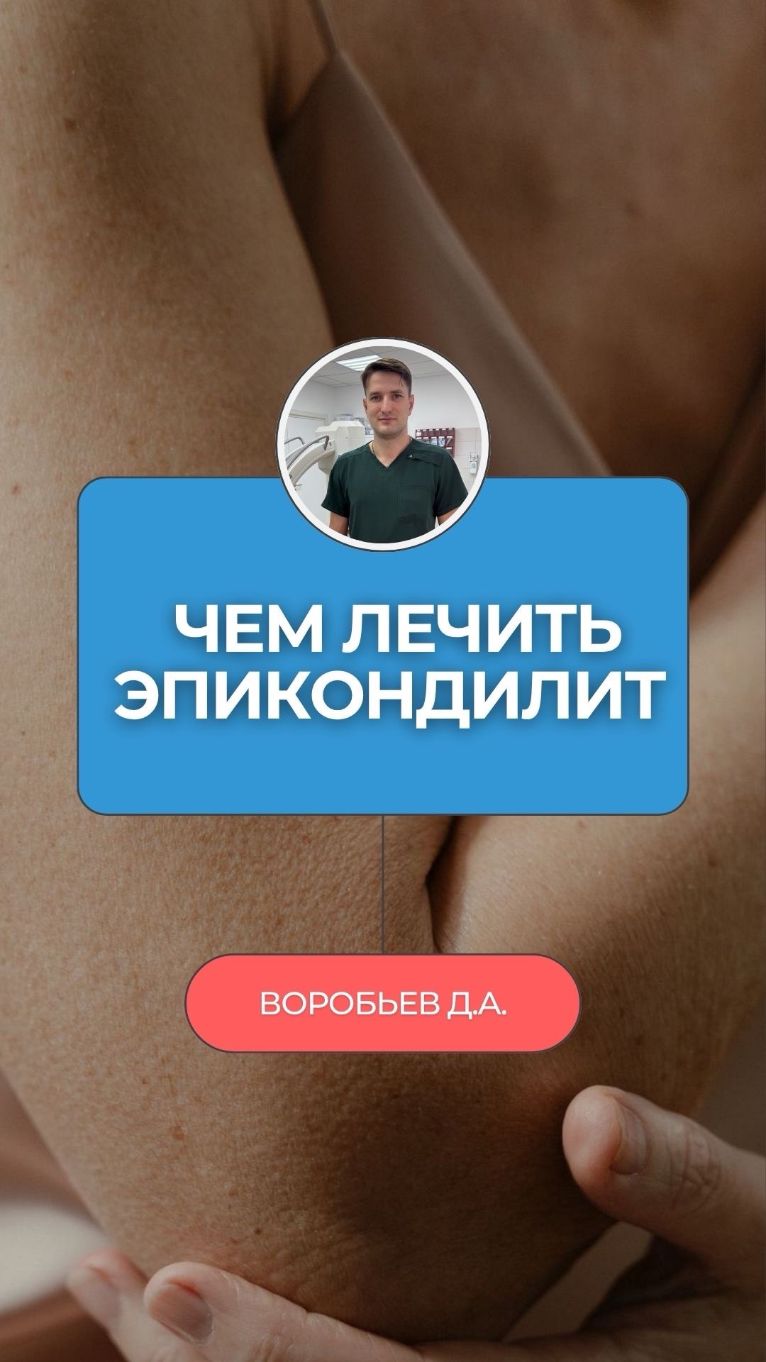 Боль в локте — и ты роняешь чашку. Не потому что неловкий. У тебя рвётся сухожилие 👇
