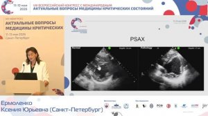 Место ультразвуковой навигации в диагностике сепсиса у детей. Ермоленко К.Ю.