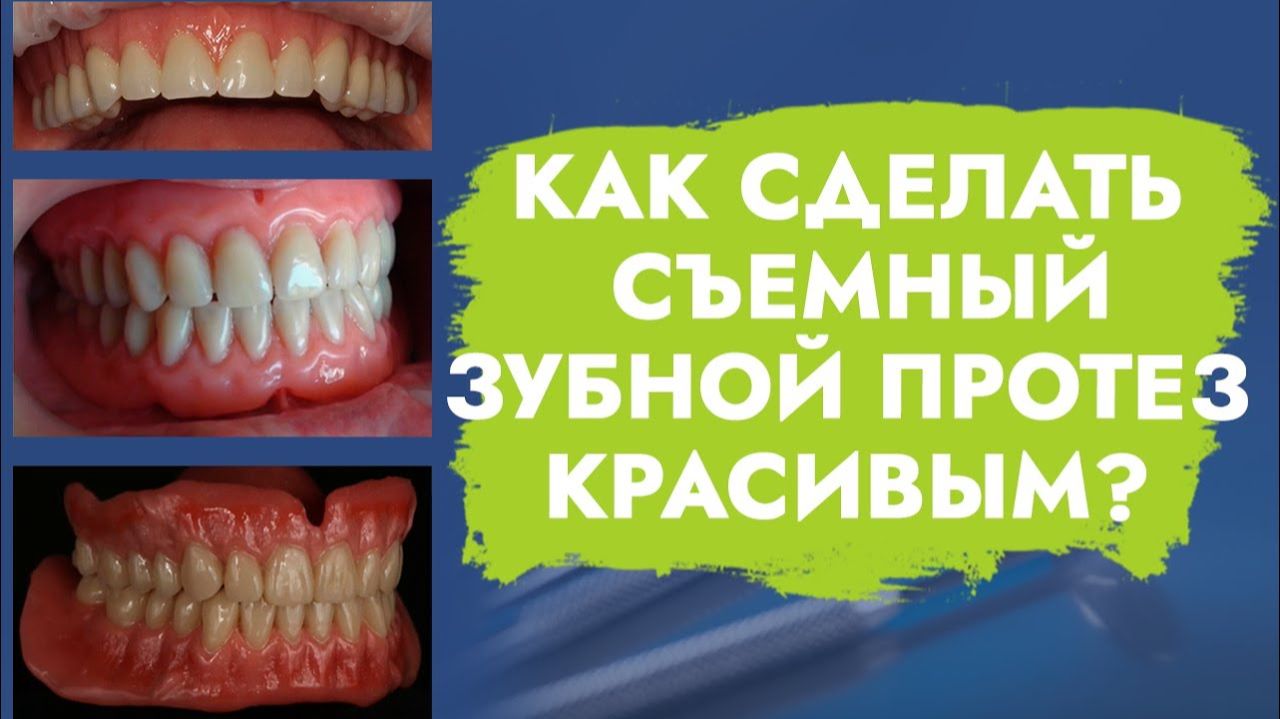Эстетика съемного зубного протеза выше, чем несъемного!
