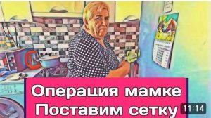 САМВЕЛ АДАМЯН, ОБЗОР ОТ ОЛЬГИ, НОВАЯ ОПЕРАЦИЯ МАМКЕ, СЕТКУ ПОСТАВИМ ЭНДОСКОПИЧЕСКИ..