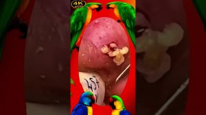 Удовлетворительное самоочищение от прыщей и черных точек