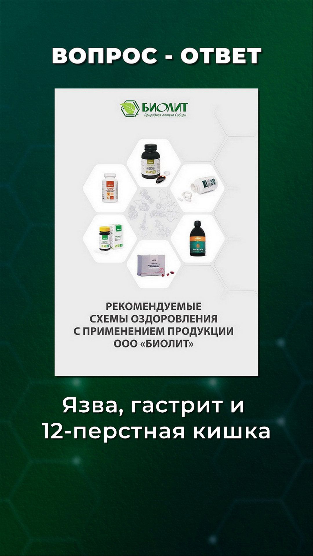 Язва, гастрит и 12-перстная кишка