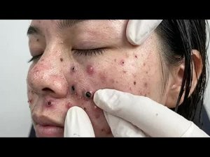 Расслабляющий уход за кожей: очищение для душевного спокойствия