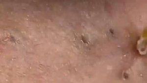 Советы по очищению и уходу за лицом