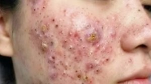 🧖 Нежное очищение лица и уход за кожей для глубокого расслабления