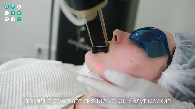 УЛУЧШЕНИЕ ЦВЕТА ЛИЦА В КЛИНИКЕ КОСМЕТОЛОГИИ GEN87
