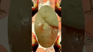 Satisfying self-cleaning of blackheads Acne Treatment Pimple pop