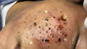 Обретите внутренний покой с помощью этих методов очищения лица