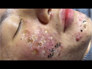 Обретите внутренний покой с этими методами очищения лица