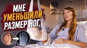 Операция на ноги_ винты в костях и уменьшение размера стопы