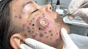 Достигните внутреннего покоя с помощью этих методов очищения лица
