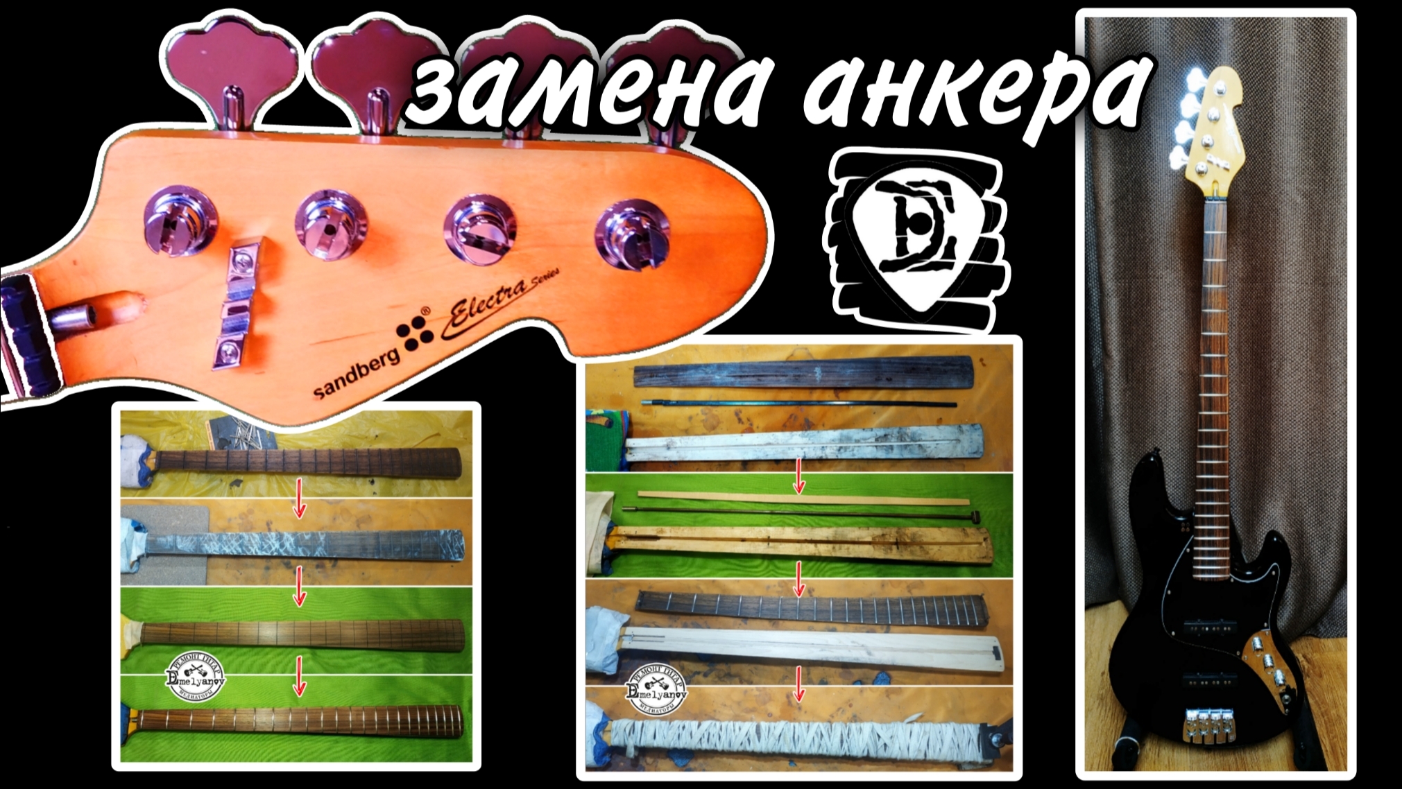 Замена двустороннего анкера на компрессионный