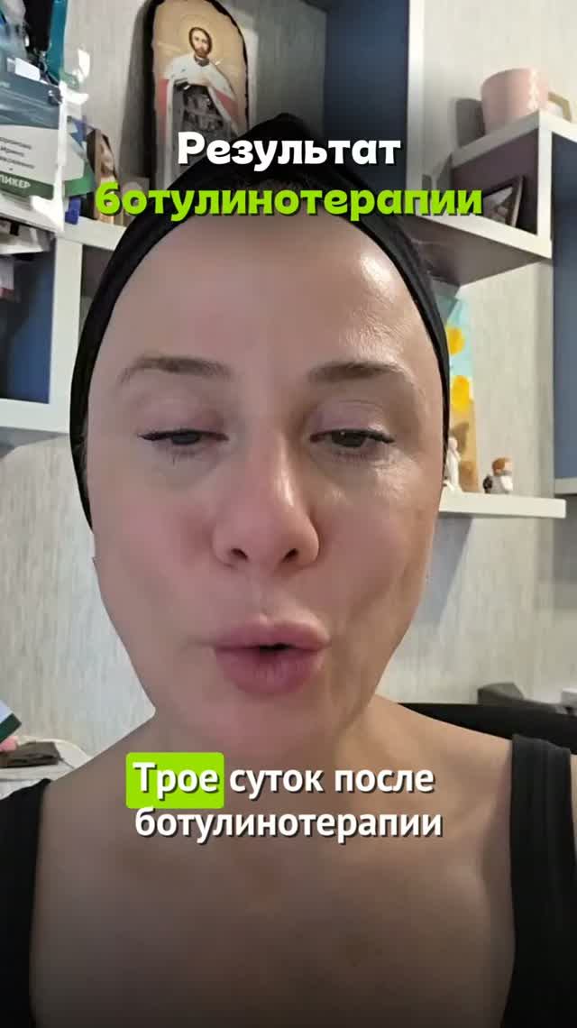 Результат ботулинотерапии #ботулотоксин #пшб #иринабаранова