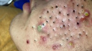 Обретите внутренний покой с помощью этих методов очищения лица