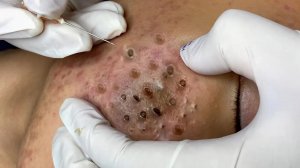 Делимся советами по очищению и уходу за лицом