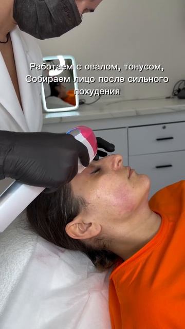 Усталое лицо| Коллагеностимуляция| Красивый овал| Экстремальное похудение| Косметолог Москва| Губы