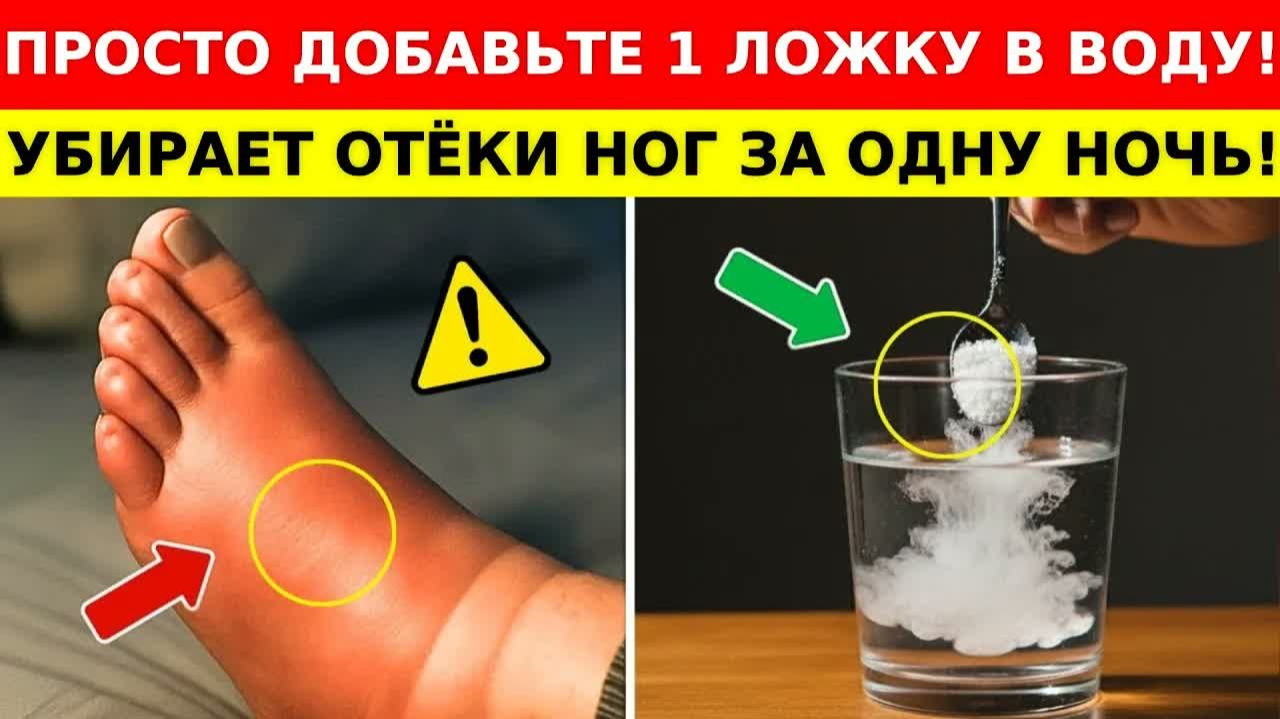 Отёк ног - 7 вечерних способов снять за одну ночь 😴 Советы для пожилых