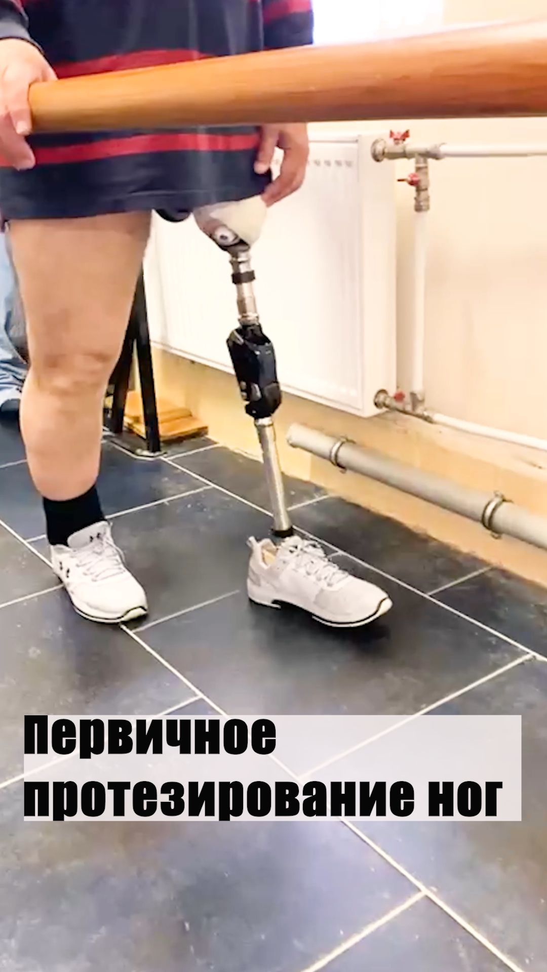 Первичное протезирование ног
