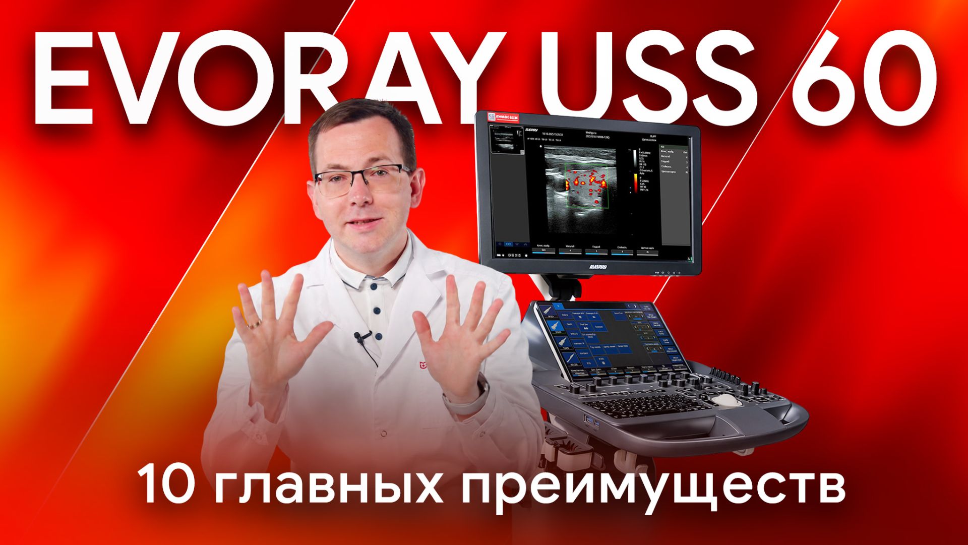 ТОП-10 преимуществ УЗИ аппарата EVORAY USS 60: что получает клиника с одной системой?