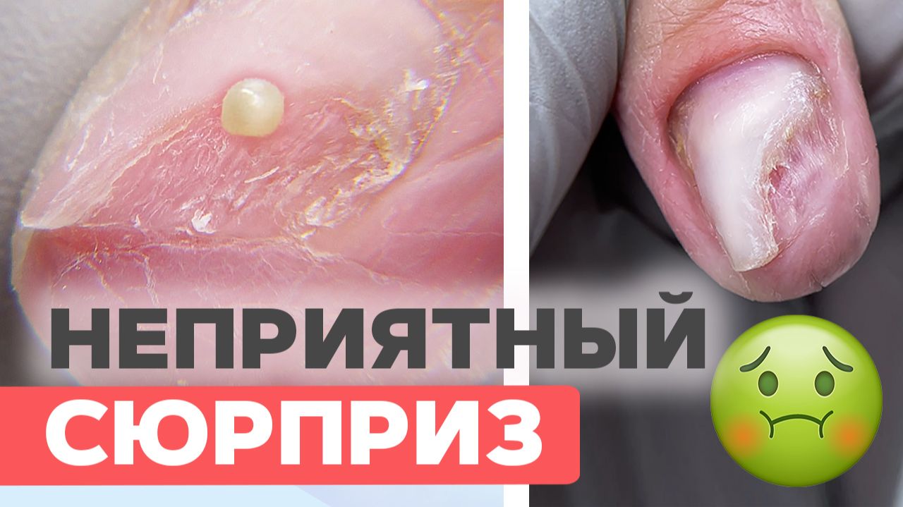 Сняли покрытие и были в шоке! Что скрывалось под ногтями?