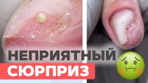 Сняли покрытие и были в шоке! Что скрывалось под ногтями?