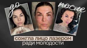 Лазер CO2: как я решилась на травматичные косметологические процедуры и что из этого вышло