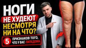 5 ПРИЗНАКОВ ЛИПЕДЕМЫ! Почему ноги не худеют, что бы вы ни делали?