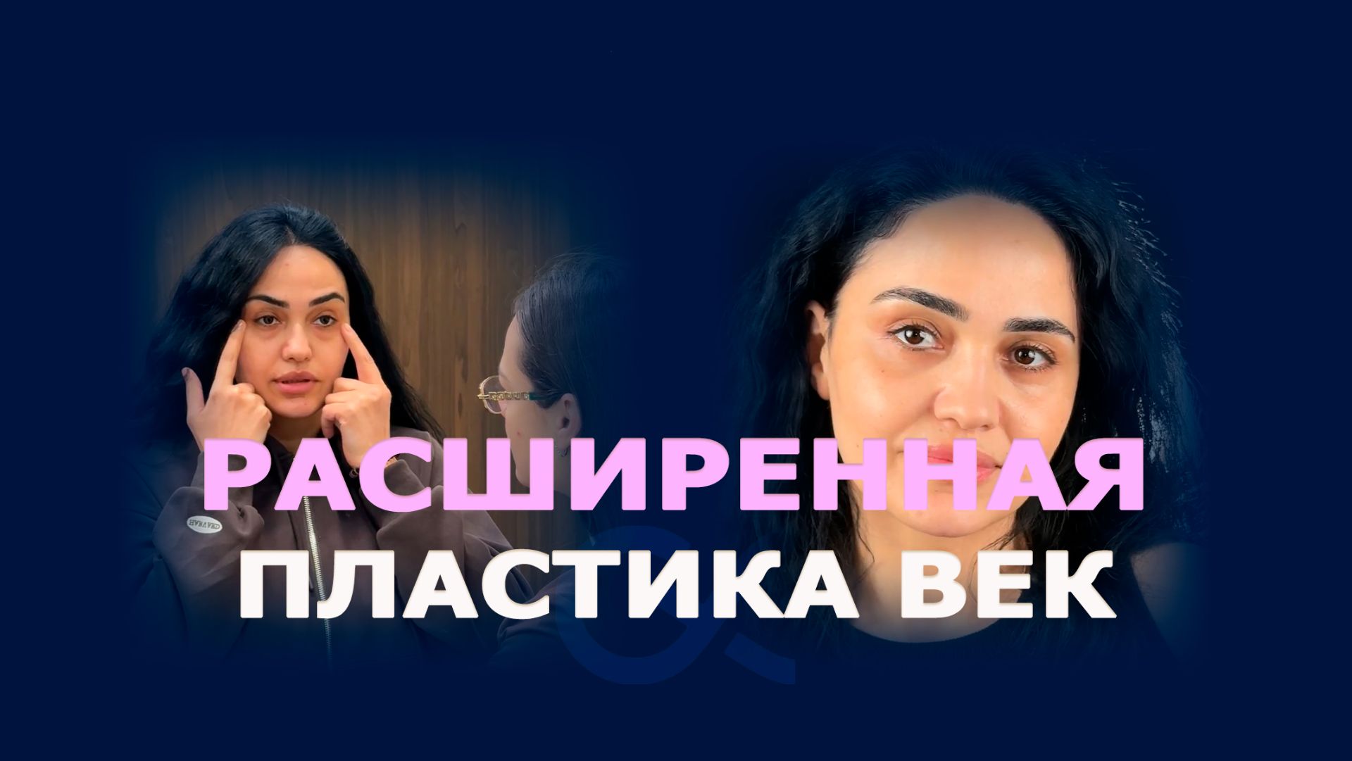 Расширенная нижняя блефаропластика: динамика восстановления