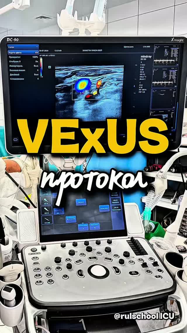 VExUS ПРОТОКОЛ