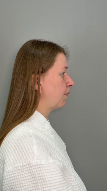 Дневник пациентки Екатерины - Эстетические особенности
