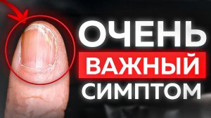 Ногти могут сказать вам об ОЧЕНЬ многом... Это природный ИНДИКАТОР?!