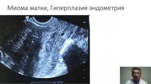 Анализ коротких видео по теме Малый таз, часть 3